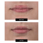 CurrentBody Skin LED Lip Perfector - Lábios Perfeitos