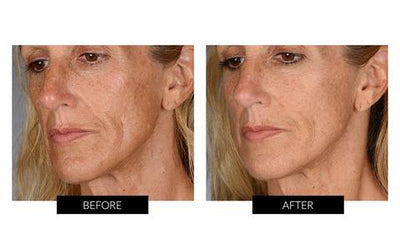 BeautyBio The Complete Glo (worth £509)