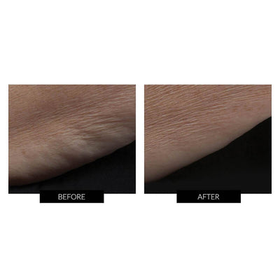 NuBODY Skin Toning Kit